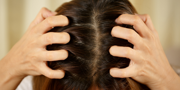 ¿Alergia en el cuero cabelludo?